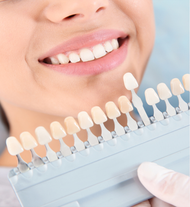 cosmetic-dentistry5